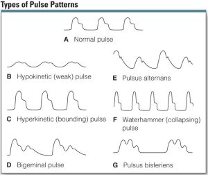 Types of Patterns for Pulse Pattern Generation 